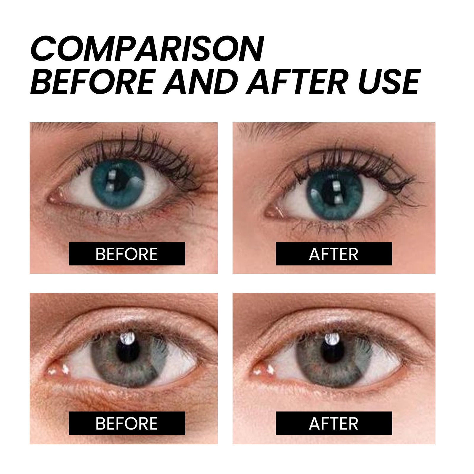 Aresify® Temporary Face Tightener