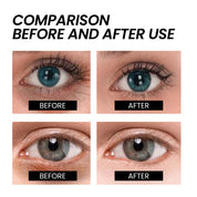 Aresify® Temporary Face Tightener