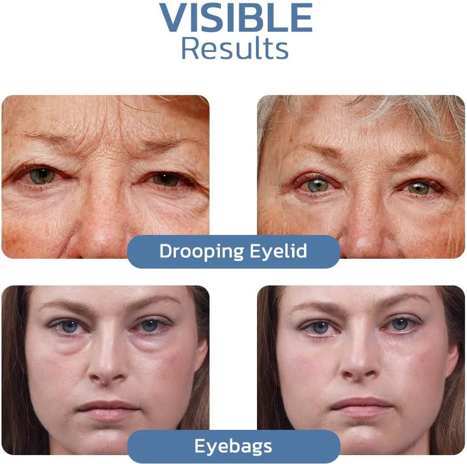 🔥Last Day Buy More Get More Free🔥Awaken Peptide Lifting Eye Gel