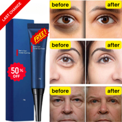🔥Last Day Buy More Get More Free🔥Awaken Peptide Lifting Eye Gel