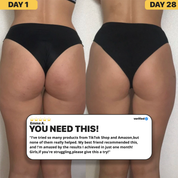 InstantBeauty Cellulite relief in 30 days