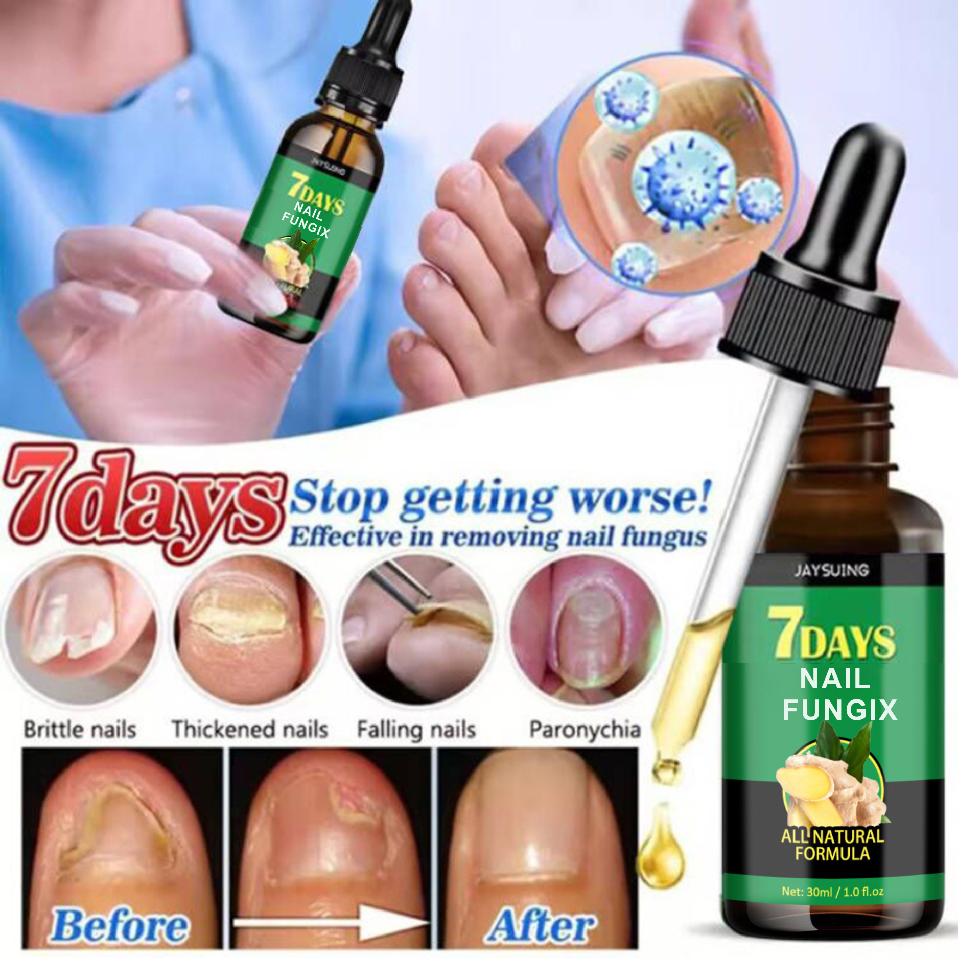 Nail Fungix