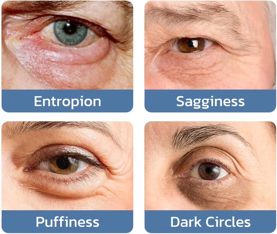 🔥Last Day Buy More Get More Free🔥Awaken Peptide Lifting Eye Gel