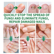 Nail Fungix