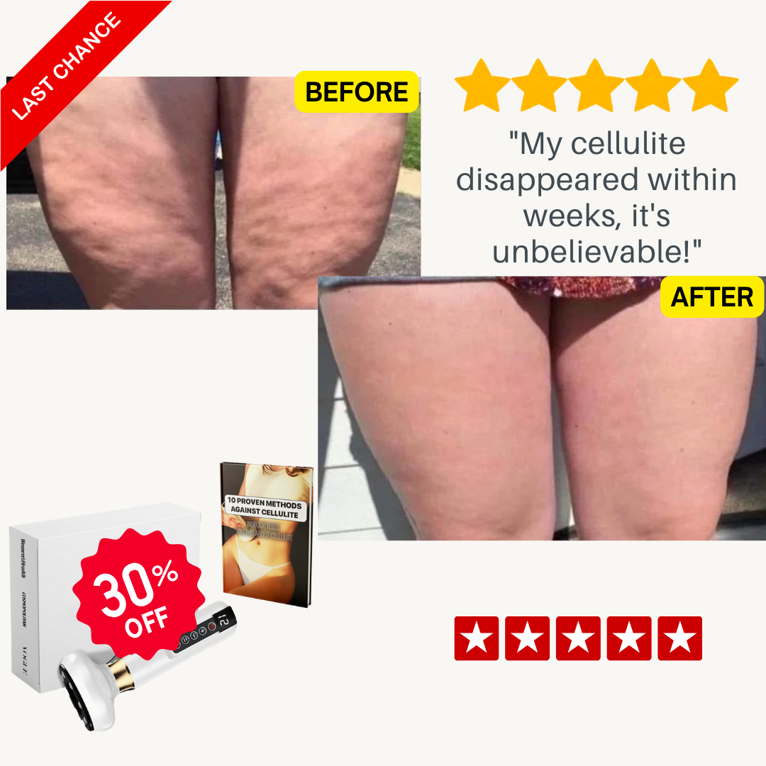 InstantBeauty Cellulite relief in 30 days