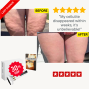 InstantBeauty Cellulite relief in 30 days