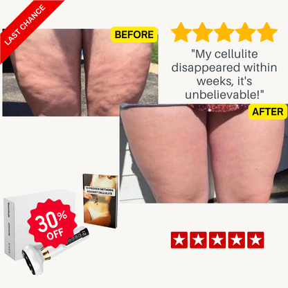 InstantBeauty Cellulite relief in 30 days