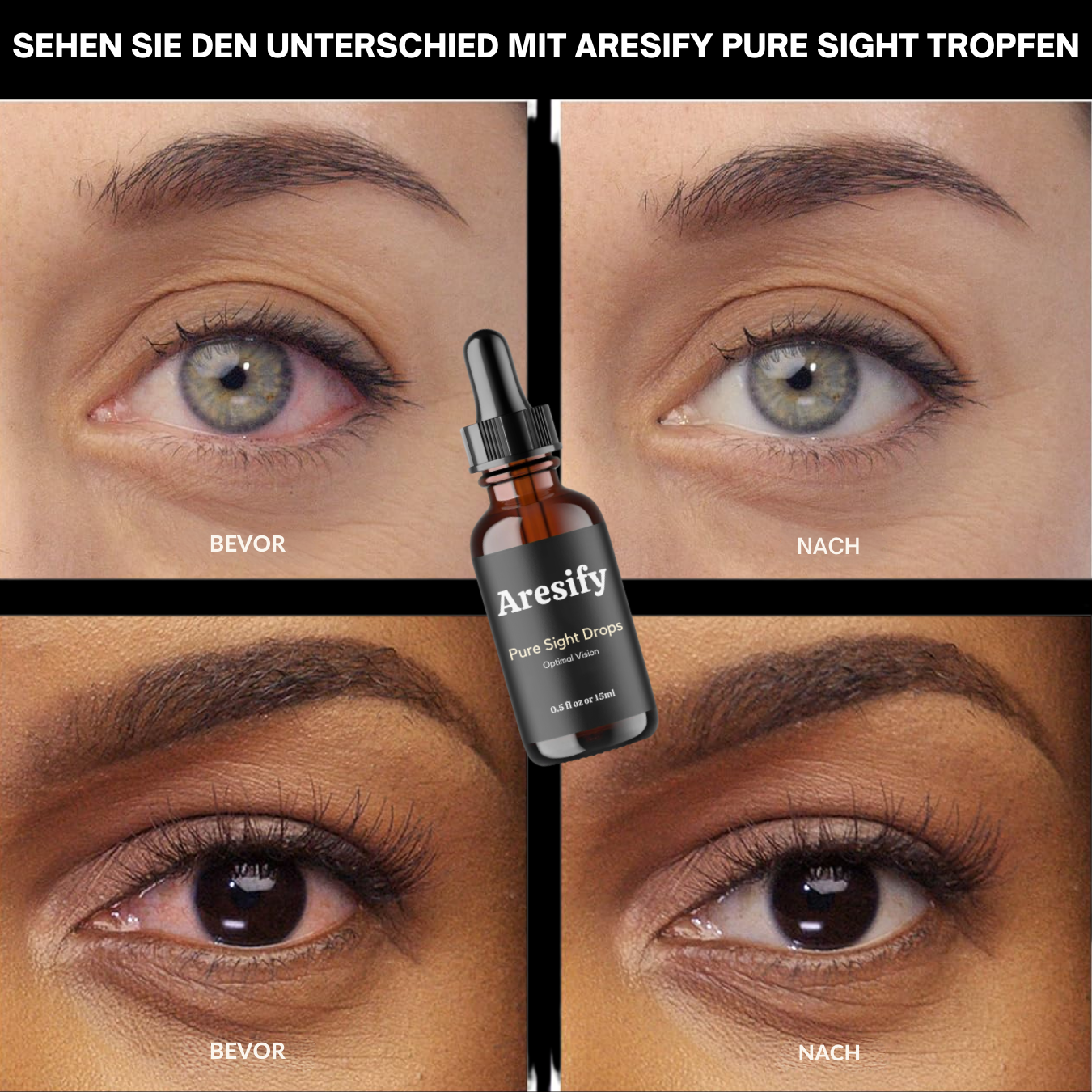 Aresify® Pure Sight Tropfen