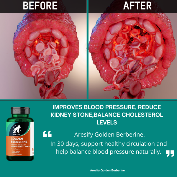 Aresify Golden Berberine