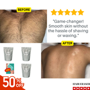 🔥50% OFF—Today Only! 🔥Body Hair Removal Powder