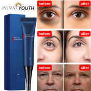 🔥Last Day Buy More Get More Free🔥Awaken Peptide Lifting Eye Gel