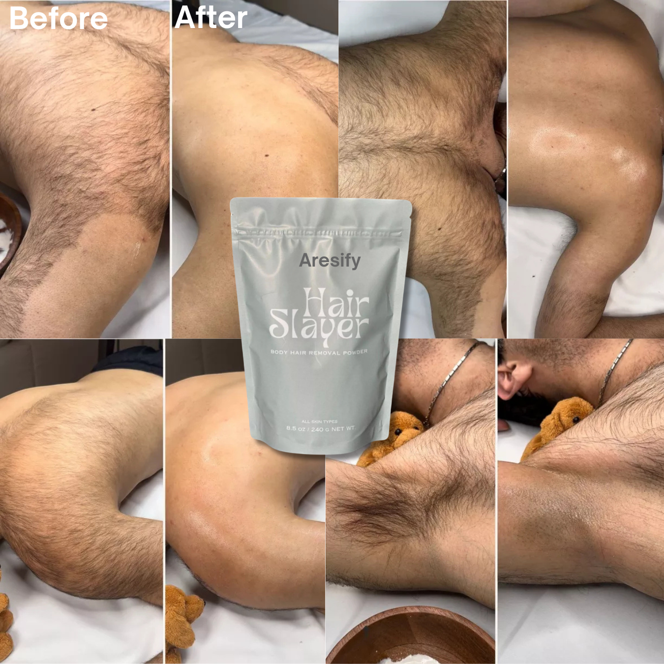 Aresify® Hair Slayer