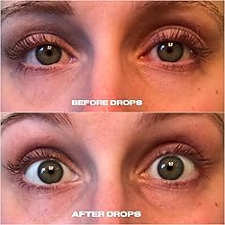 Aresify® ReduClear Drops