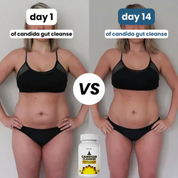 Aresify Candida Cleanse