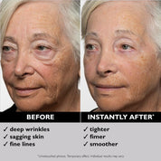 Aresify® Temporary Face Tightener