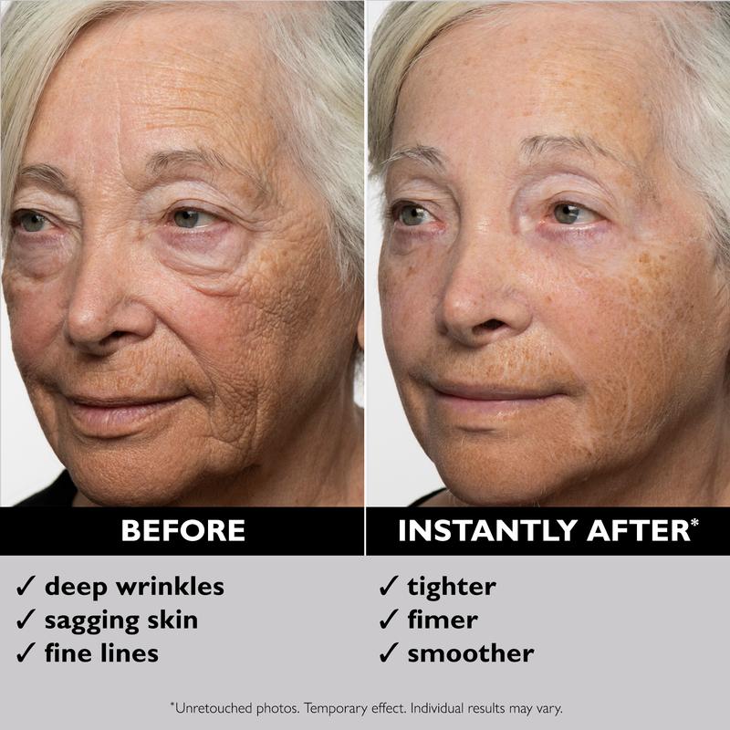 Aresify® Temporary Face Tightener