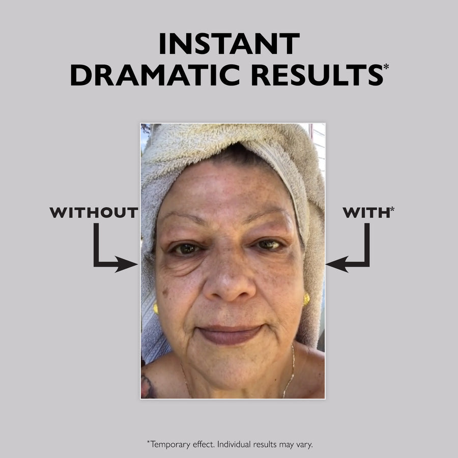 Aresify® Temporary Face Tightener