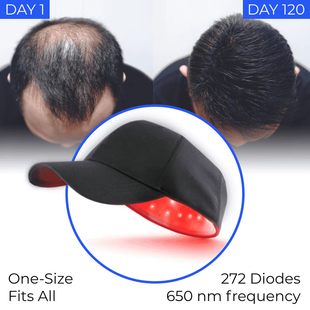 Aresify® Laser Cap