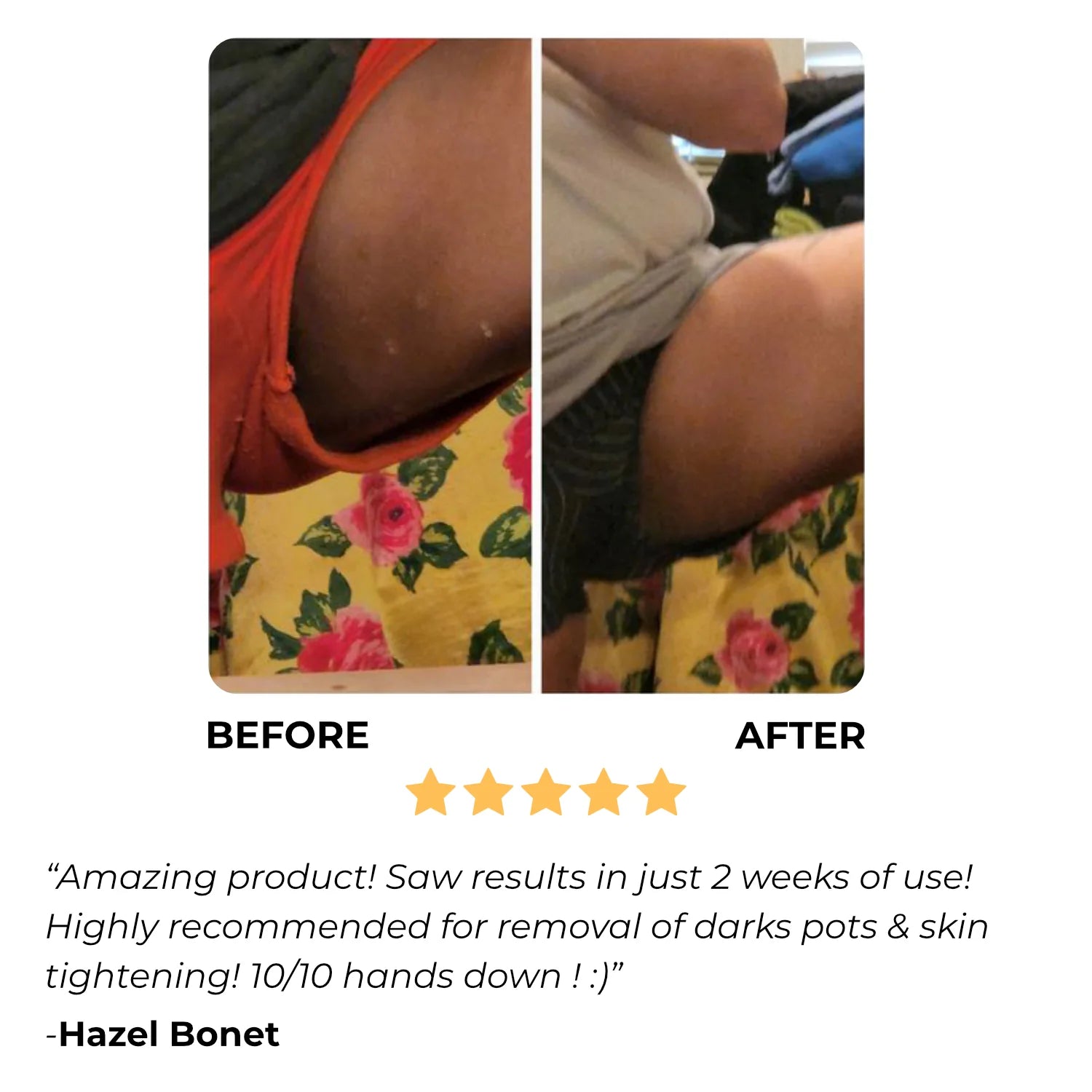 Turmeric Dark Spot Assasin Scrub